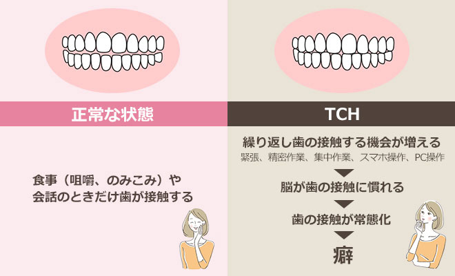 TCHが起こる原因